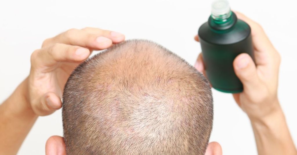 man using product for sensitive scalp